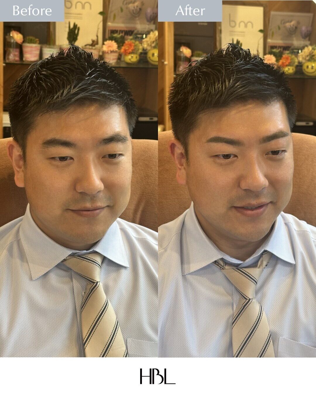 男性のHBL施術前後の比較写真。眉の毛流れが整い、顔全体の印象が引き締まっている