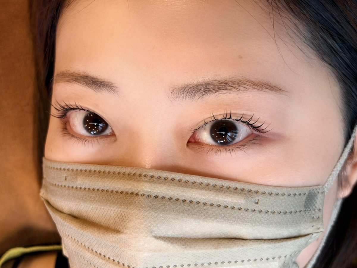 まつ毛の生え際がまぶたに隠れている目元